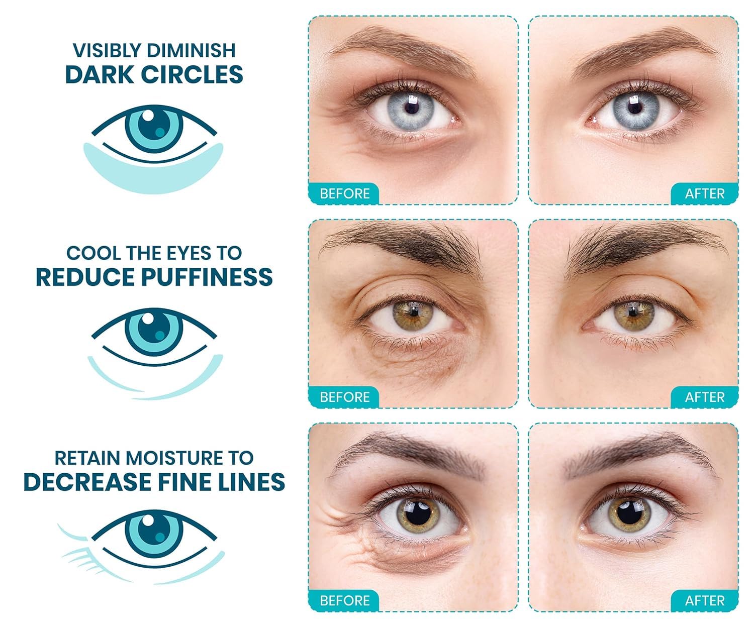 Revitalize Your Eyes! 🌟 Try Stylia's Vegan Collagen & Vitamin C Under Eye Patches for Dark Circles & Puffiness - 30 Pairs of Hydrating Magic! 💧✨ #SkincareGoals #CrueltyFree