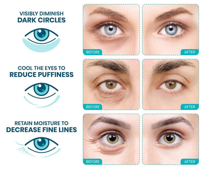 Revitalize Your Eyes! 🌟 Try Stylia's Vegan Collagen & Vitamin C Under Eye Patches for Dark Circles & Puffiness - 30 Pairs of Hydrating Magic! 💧✨ #SkincareGoals #CrueltyFree